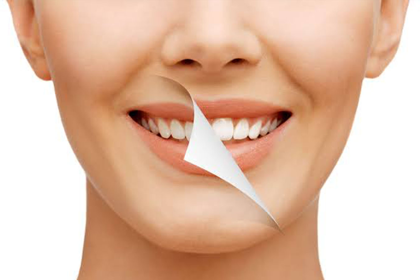 Smile Makeover in Ulwe